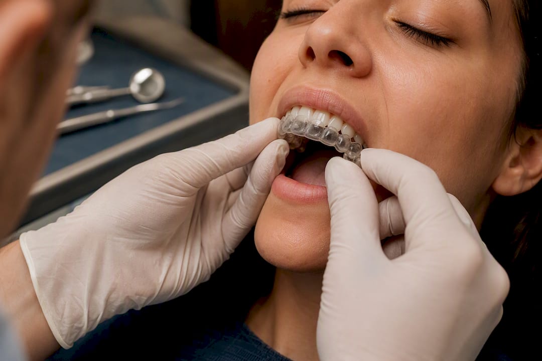 Dentist fitting custom night guard