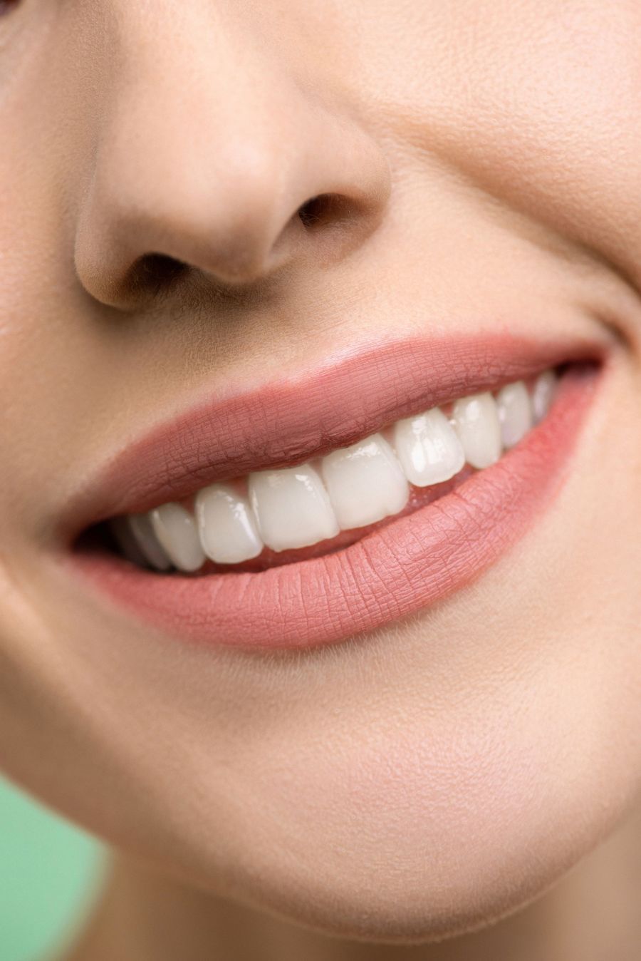 Composite Bonding