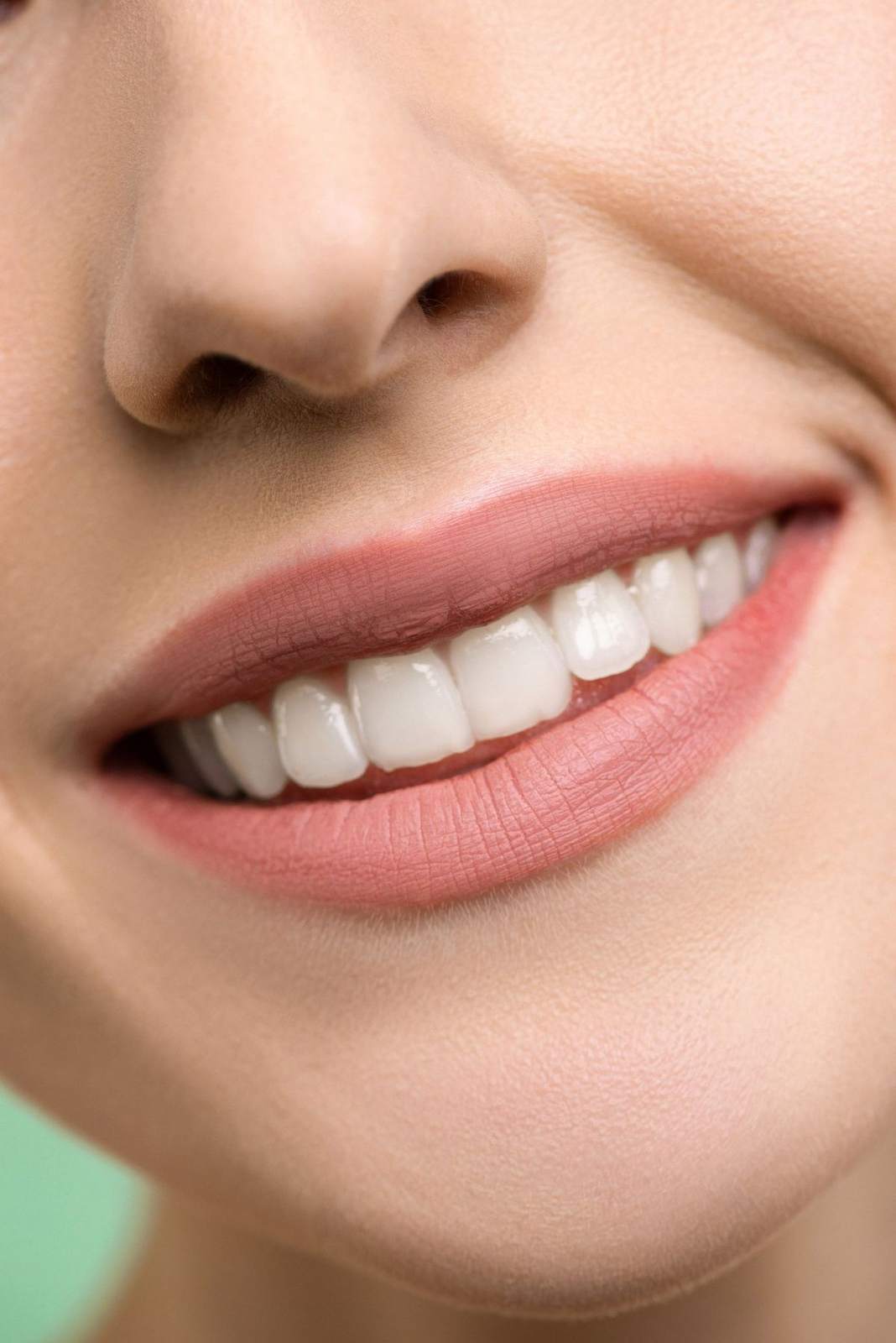 Composite Bonding treatment at TJ Smile Studio, Glasgow