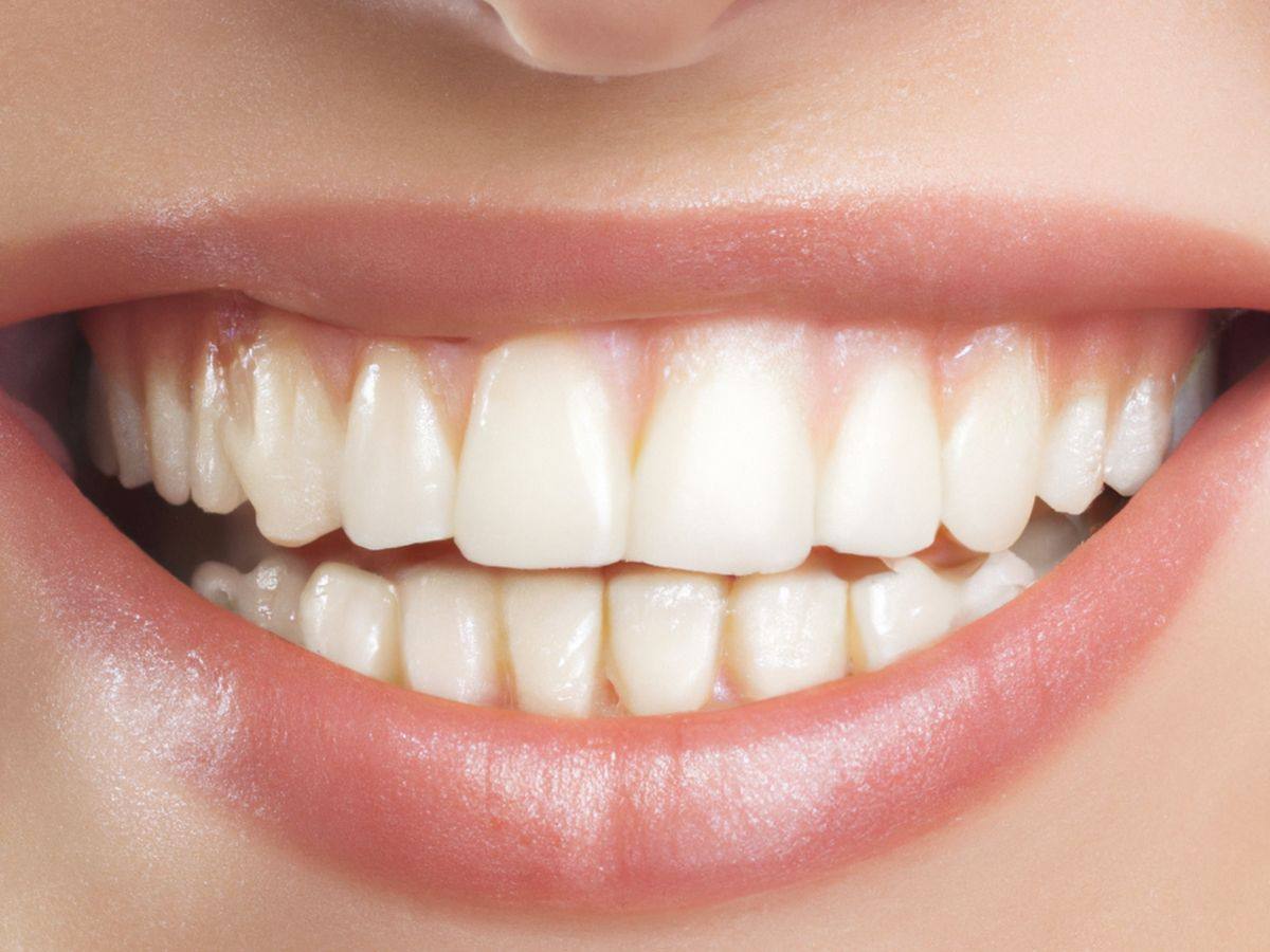 Teeth Whitening treatment at TJ Smile Studio, Glasgow